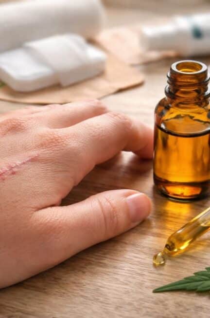 découvrez si le cbd favorise réellement la cicatrisation ou s'il s'agit d'un mythe. analyse des bienfaits et des limites du cbd dans le processus de guérison.